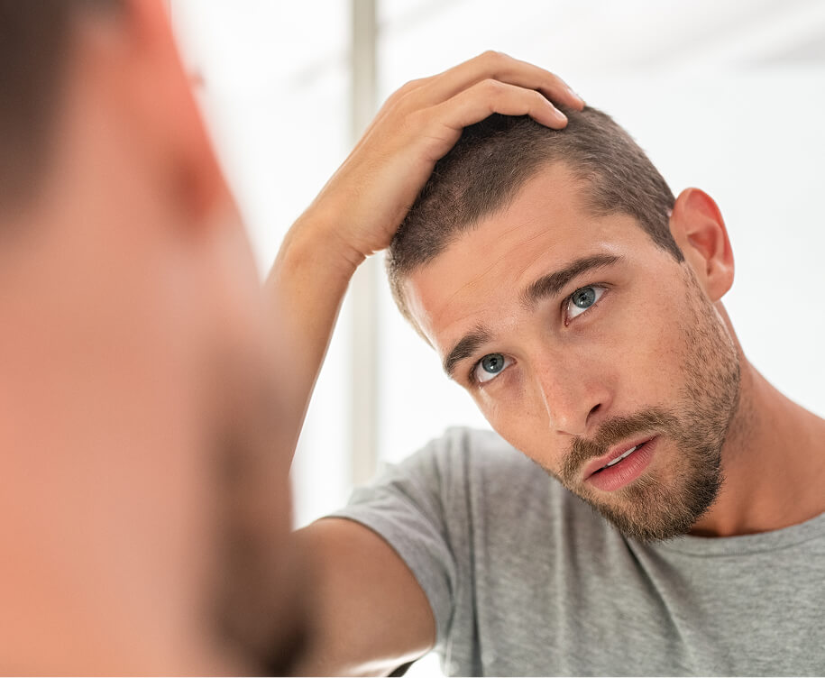man-hair-loss (1)
